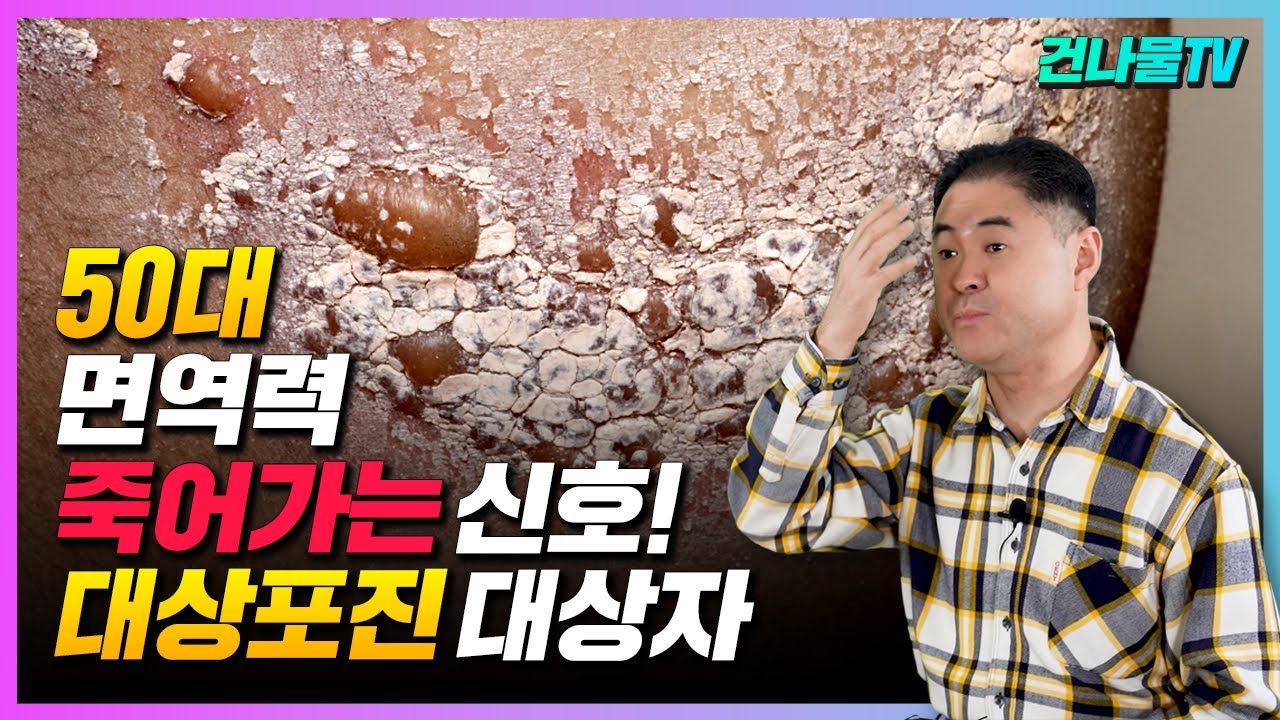 면역력 죽어가는 신호! 대상포진 대상자 50세 이상 꼭 확인 하세요~
