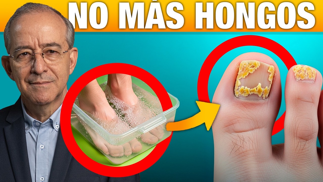 🦶 Si tus uñas de los pies están amarillas y gruesas, esto es lo que tienes - Oswaldo Restrepo RSC