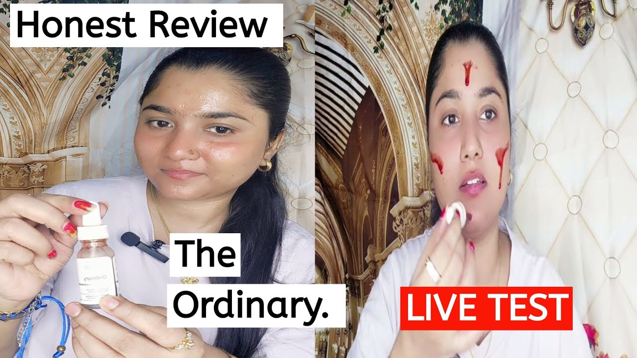 The Ordinary Serum AHA 30% BHA 2% peeling Solution | 1 Step Facial At Home | Honest Review 