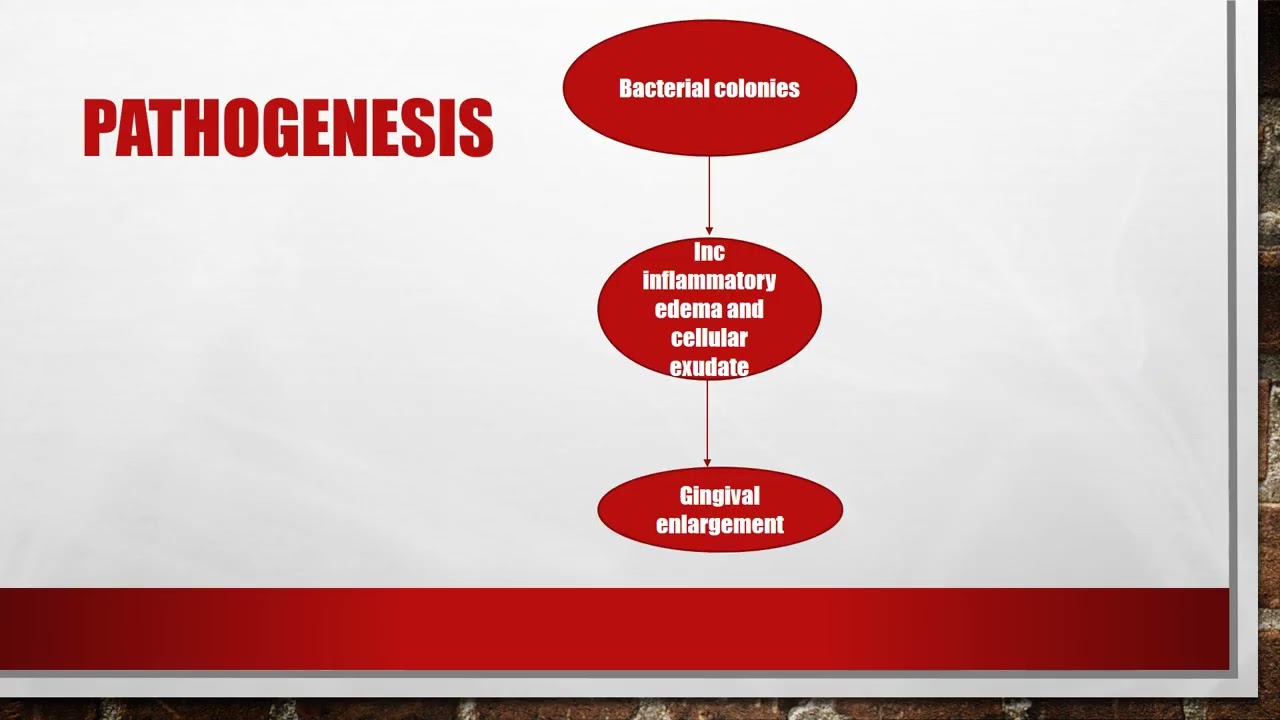 Gingival Enlargement & its Management C027