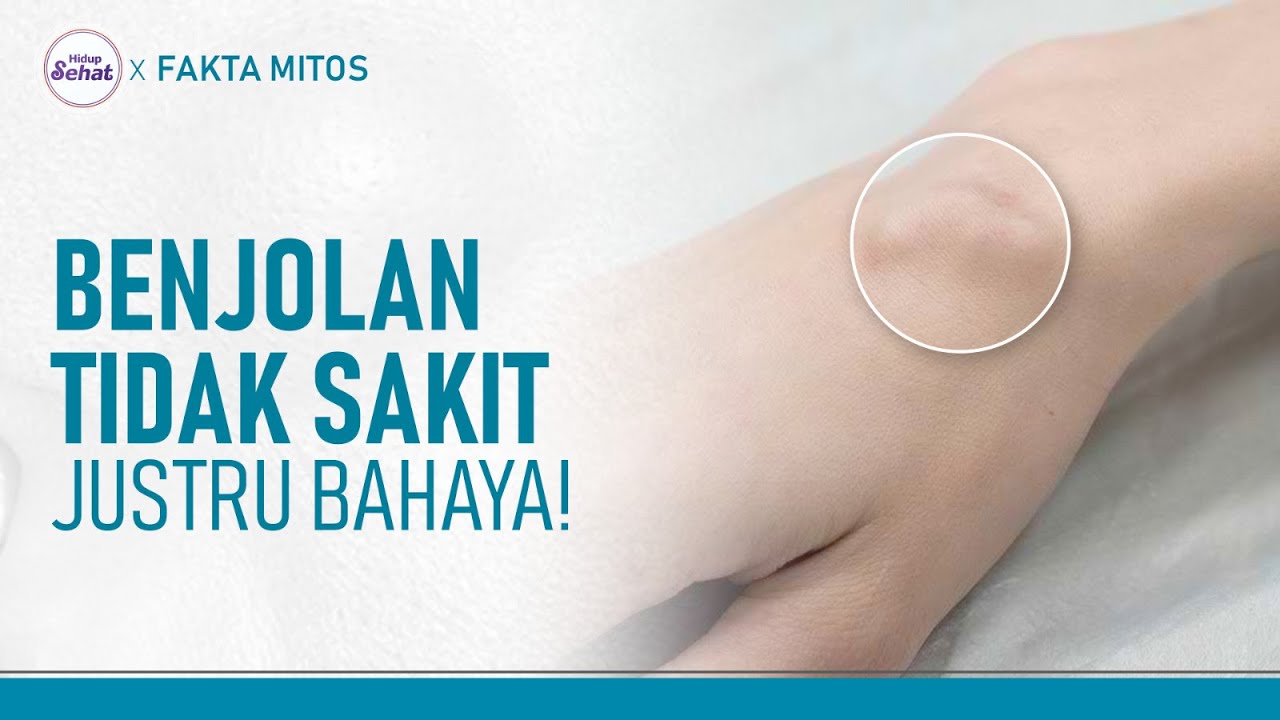 Berbagai Penyebab Benjolan di Tubuh, yang Tidak Sakit harus Diwaspadai! | Hidup Sehat tvOne