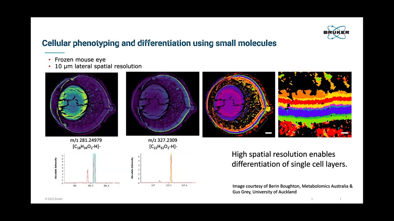 Spatial Awareness with MALDI Imaging