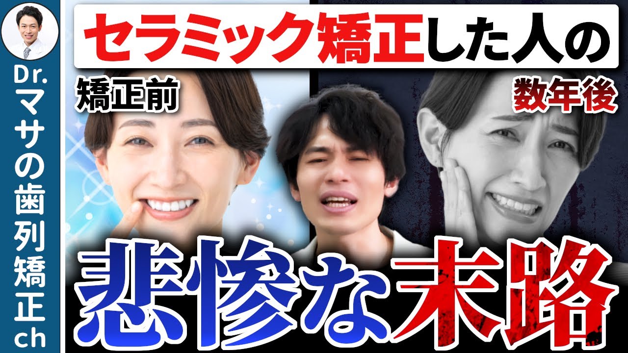 【実話】セラミック矯正のせいで20代で入れ歯になった、ある女性の話