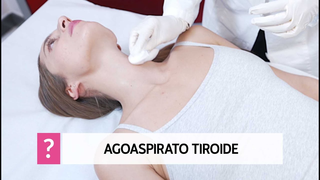 Agoaspirato tiroideo, a cosa serve e come si esegue