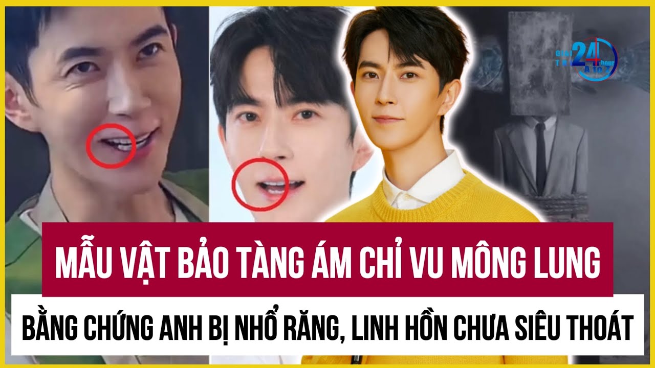 Linh hồn Vu Mông Lung chưa được siêu thoát, bằng chứng anh bị nhổ răng, mẫu vật rùng rợn ở bảo tàng