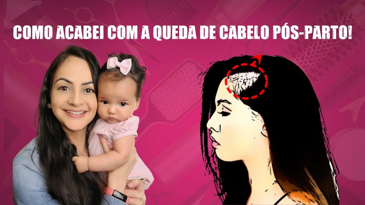 4 COISAS QUE ACABARAM COM MINHA QUEDA DE CABELO PÓS-PARTO!