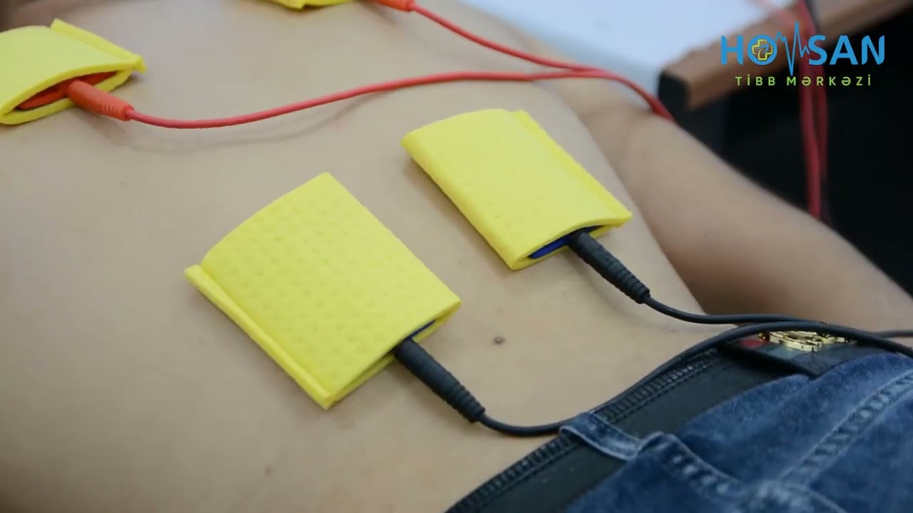 Fizioterapiya - ✅Fonoforez  ✅Elektroforez Hövsan Tibb Mərkəzində