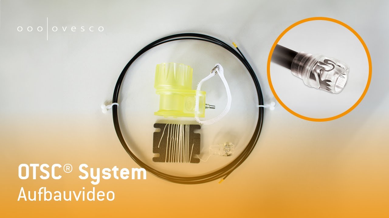 OTSC&reg; System | Aufbauvideo