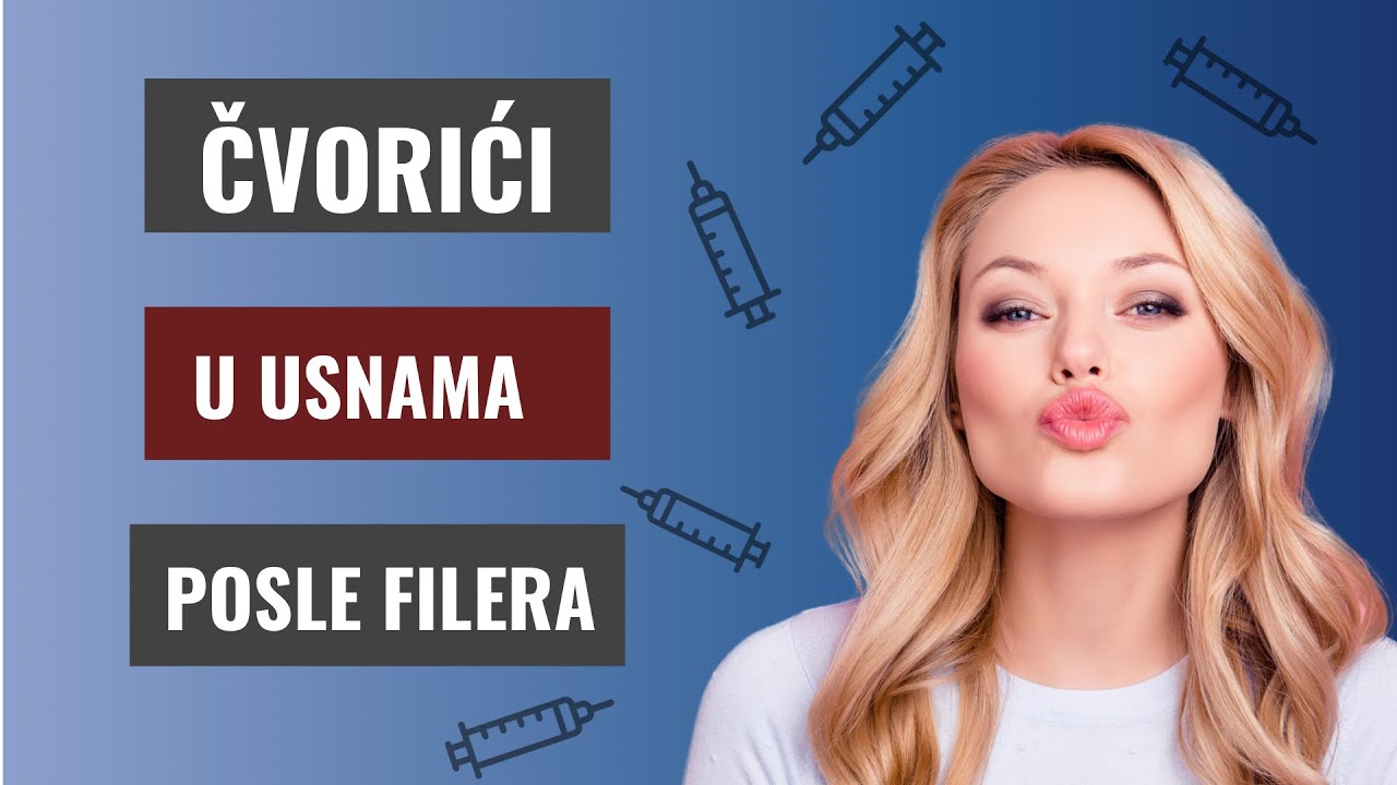Čvorići i gromuljice nakon hijaluronskih filera, dr Stojićević