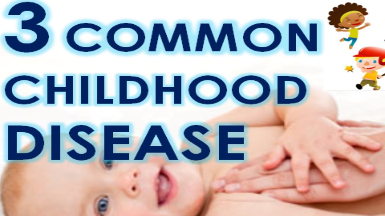 3 Common Childhood Disease