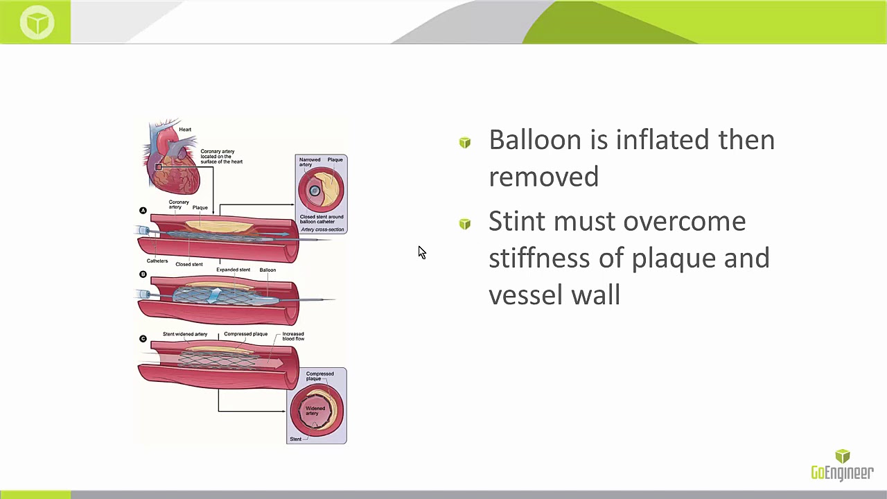 SOLIDWORKS Simulation - Medical Industry Analysis of a Nitinol Stent