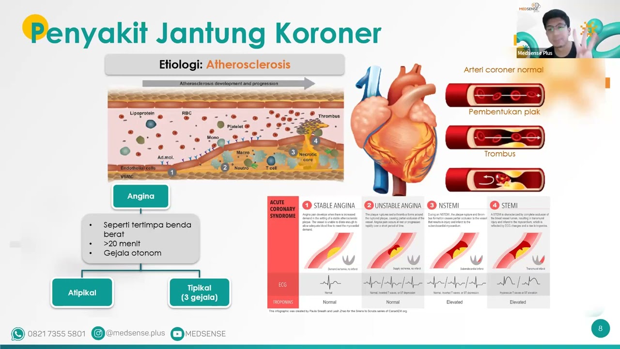 Video Recording Drill Soal UKMPPD   Kardiologi dr  Fiyandi