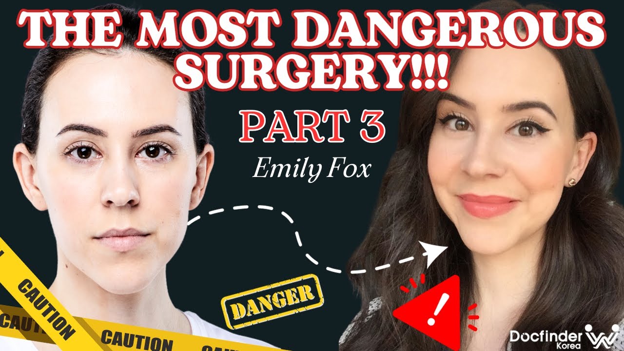 Most DANGEROUS Surgery in Korea : Two Jaw Surgery Part 3
