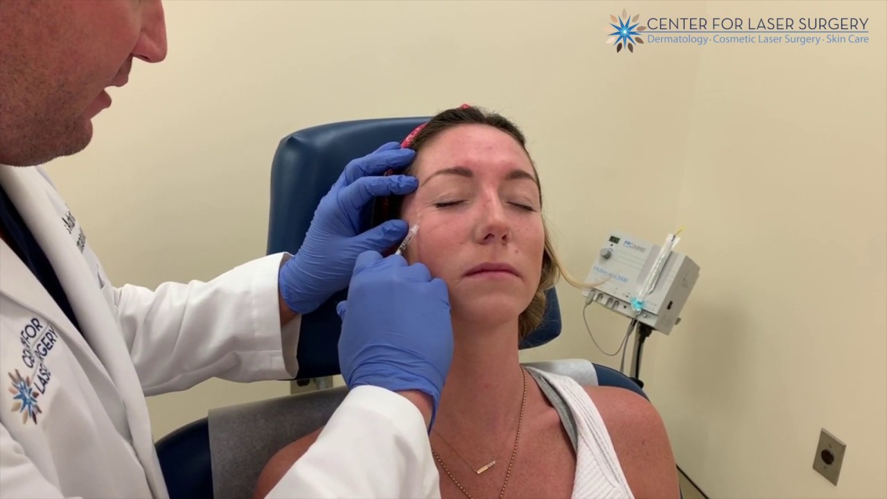 Botox Treatment of Crows Feet