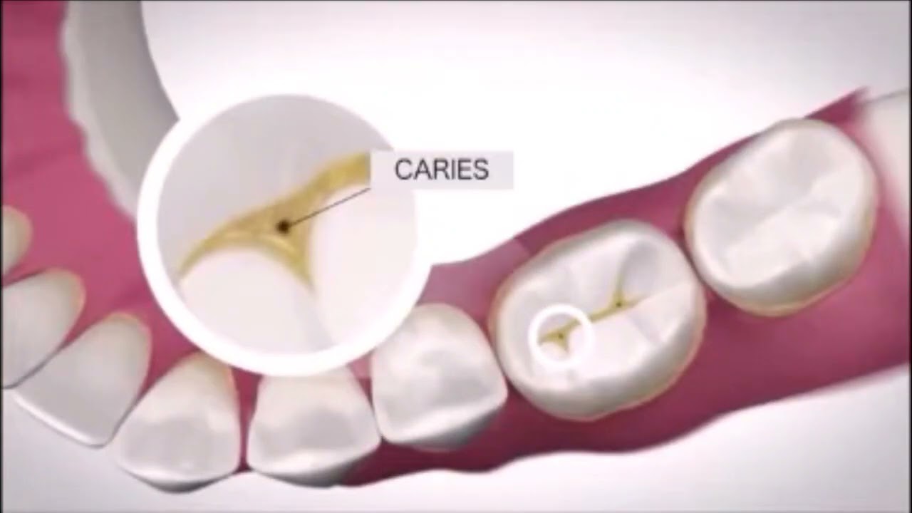 Salud oral