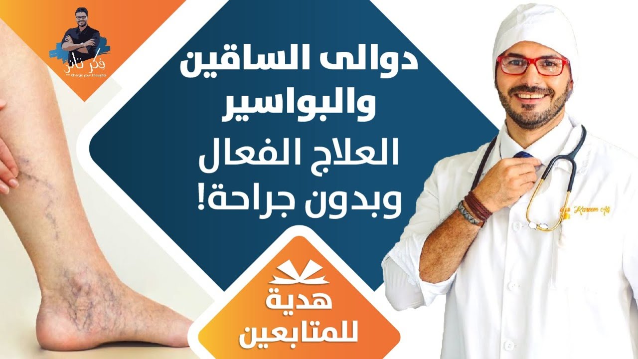 علاج البواسير و دوالي الساقين النهائي بدون جراحة بطريقة فعالة