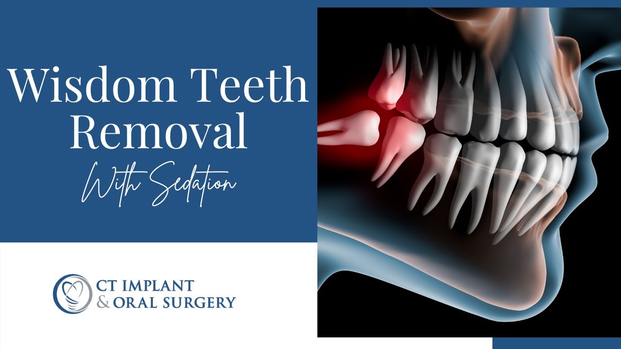 How Wisdom Teeth Removal with IV Sedation Isn’t As Bad as You Think