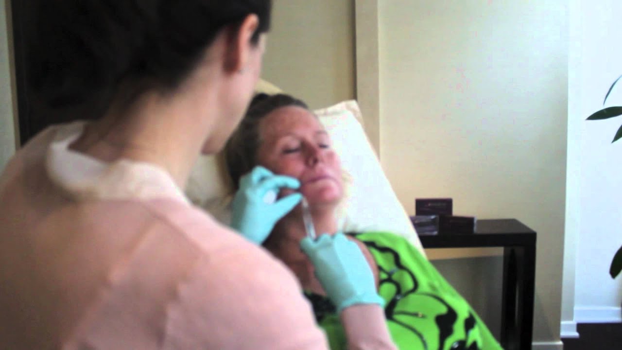 Restylane Palm Beach Plastic Surgeon Dr. Dana Goldberg Uses Fillers For The Face