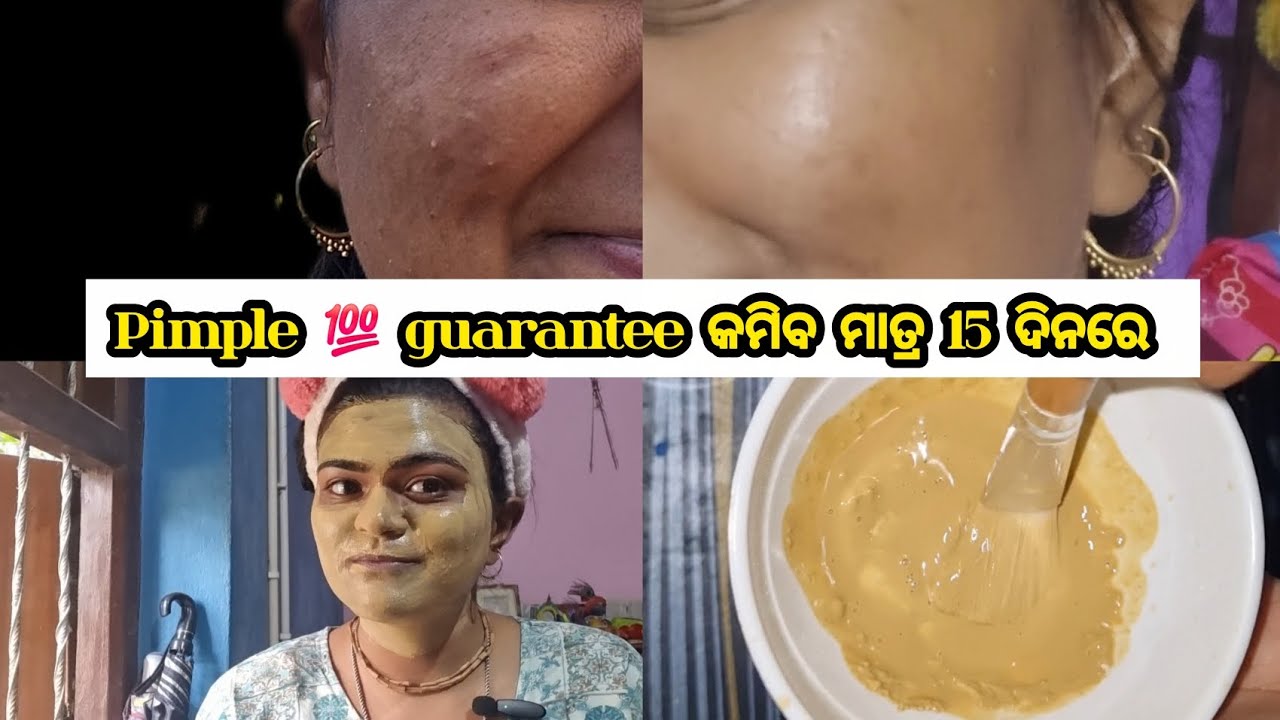 Pimple କମିବ ମାତ୍ର 15 ଦିନରେ 💯 Guarantee | 15 Days mein clear skin | DIY Face Mask for Acne #selfcare 