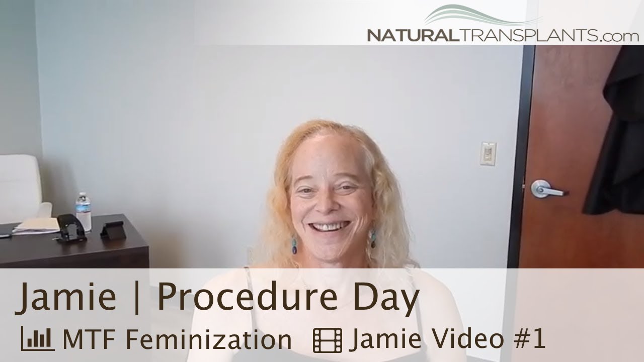 MTF Feminization Hair Transplant Procedure.  MTF transgender hair transplant in Fort Lauderdale.