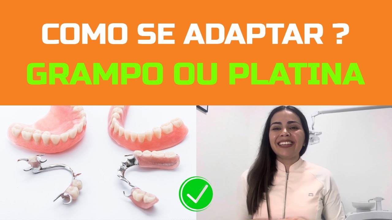 Orientação infalível de como se adaptar: prótese de grampo ou platina!