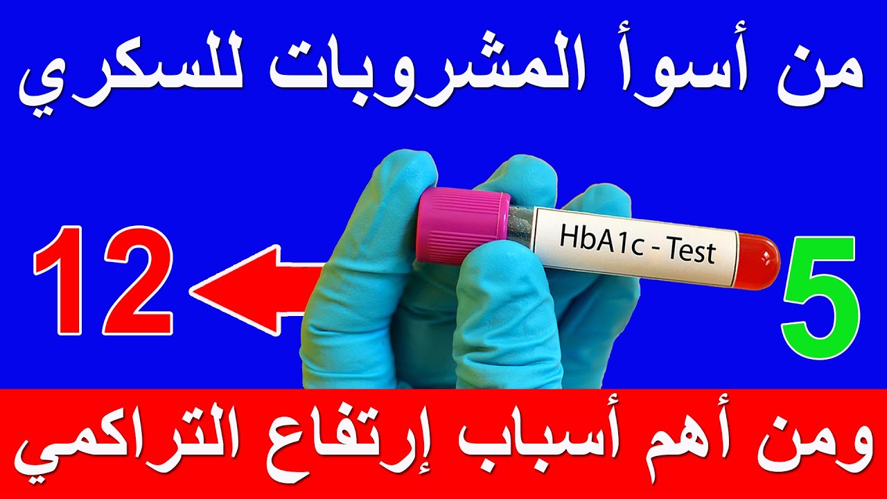 المشروبات المضرة لمرضى السكري والكوليسترول وضغط الدم والسمنة