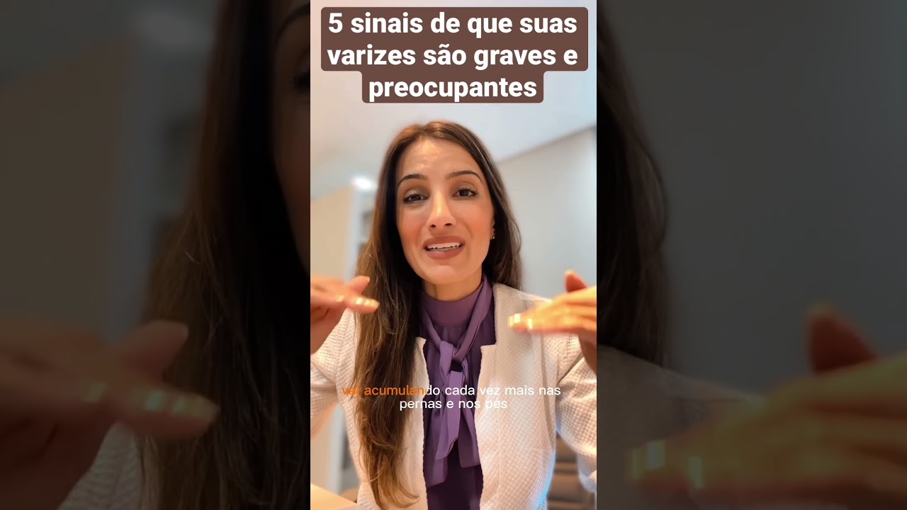 5 sinais de que suas #varizes s&atilde;o graves e voc&ecirc; precisa se preocupar com elas.