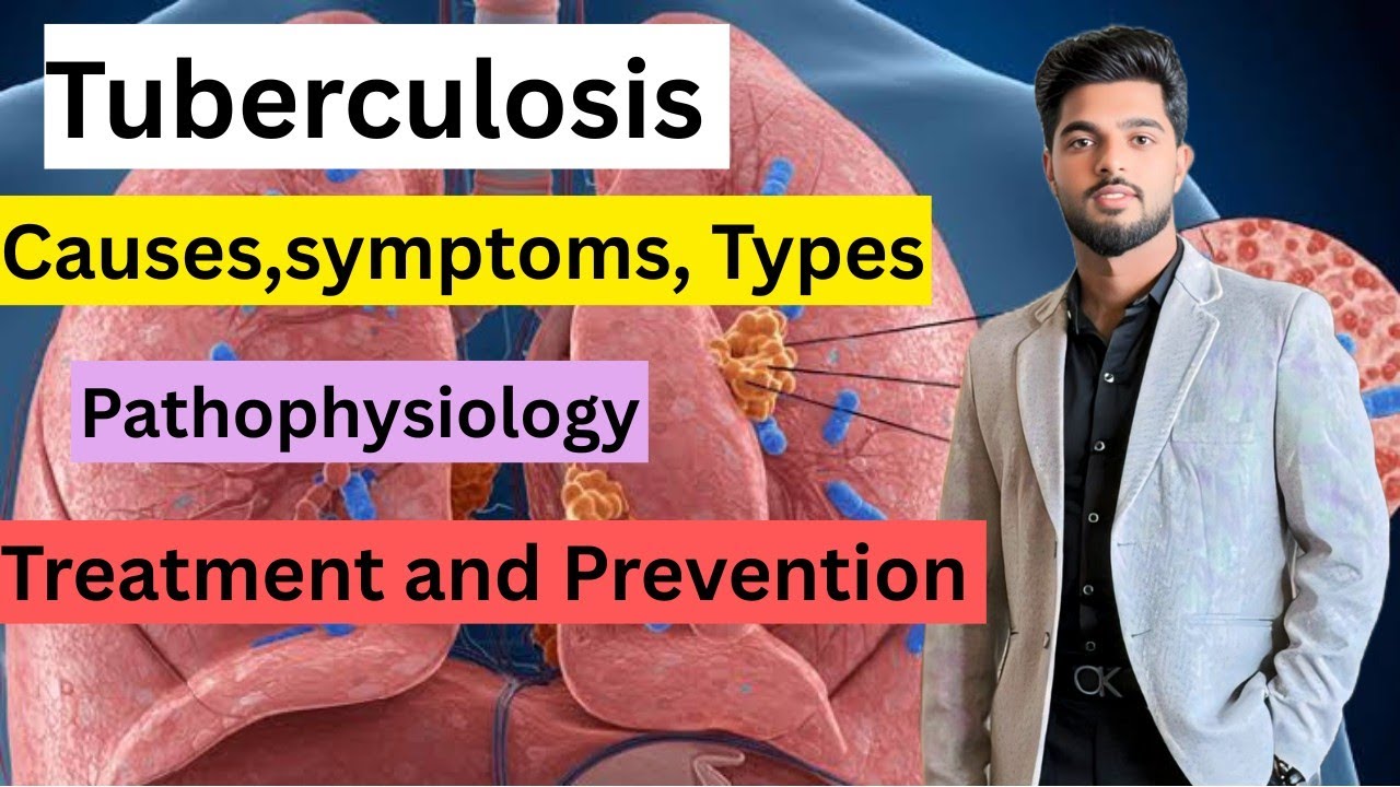 Tuberculosis Explained: Causes, Symptoms, and Prevention | TB Awareness