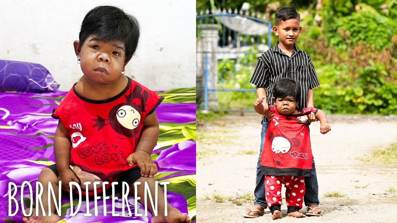 The 30-Year-Old Trapped In A Toddler's Body | BORN DIFFERENT