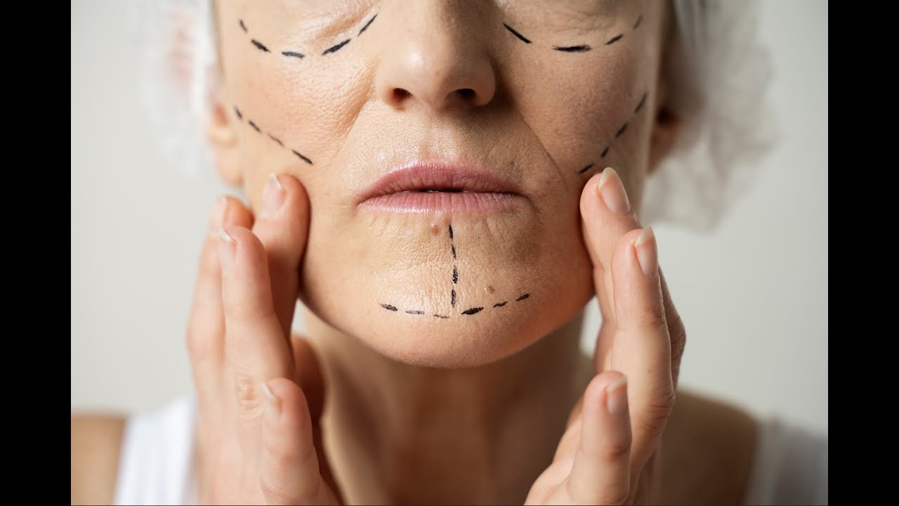 La cirugía de la parálisis facial, una solución ante el dolor, la rigidez y el aislamiento