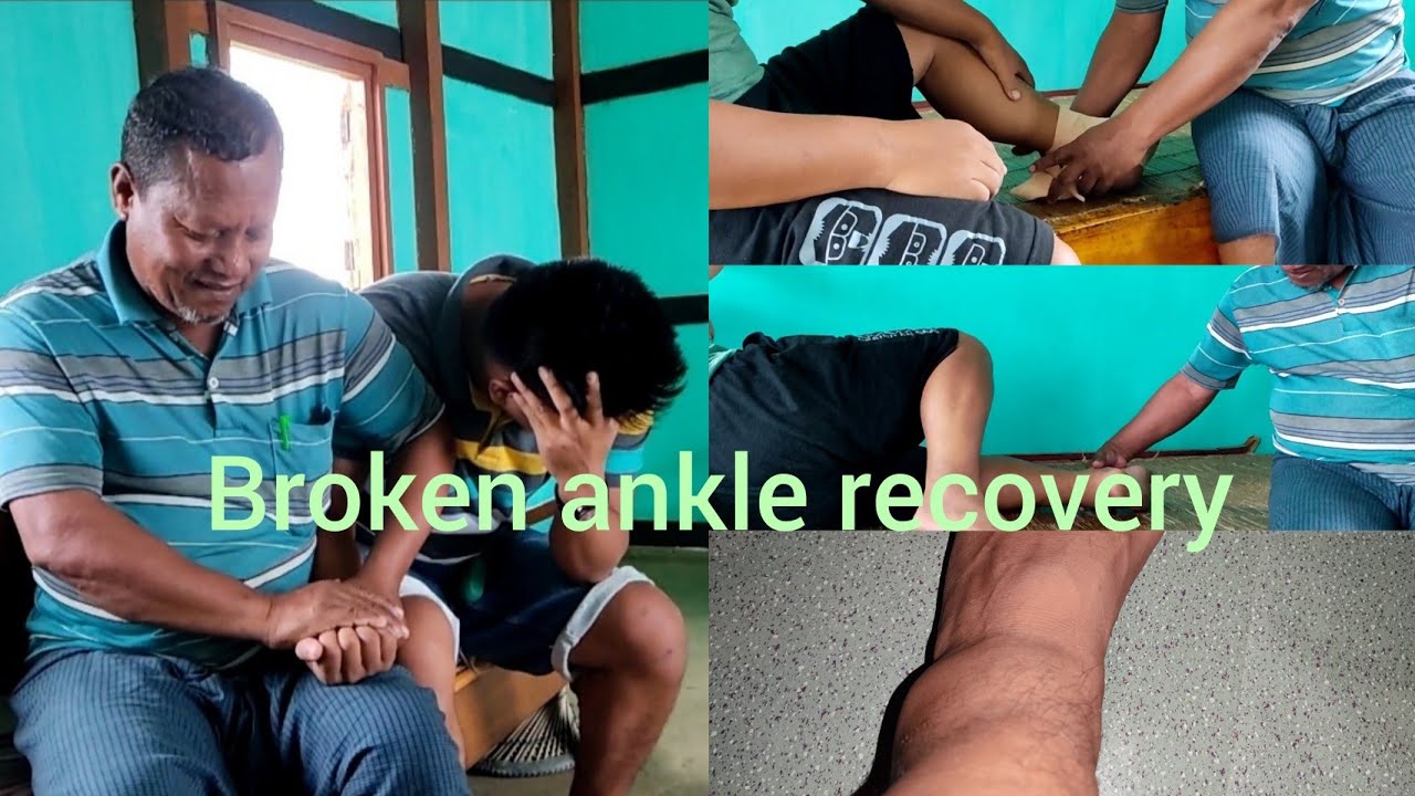 Ankle Sprain || Dr. Md. Nahachouba || Kwakta Terakhong