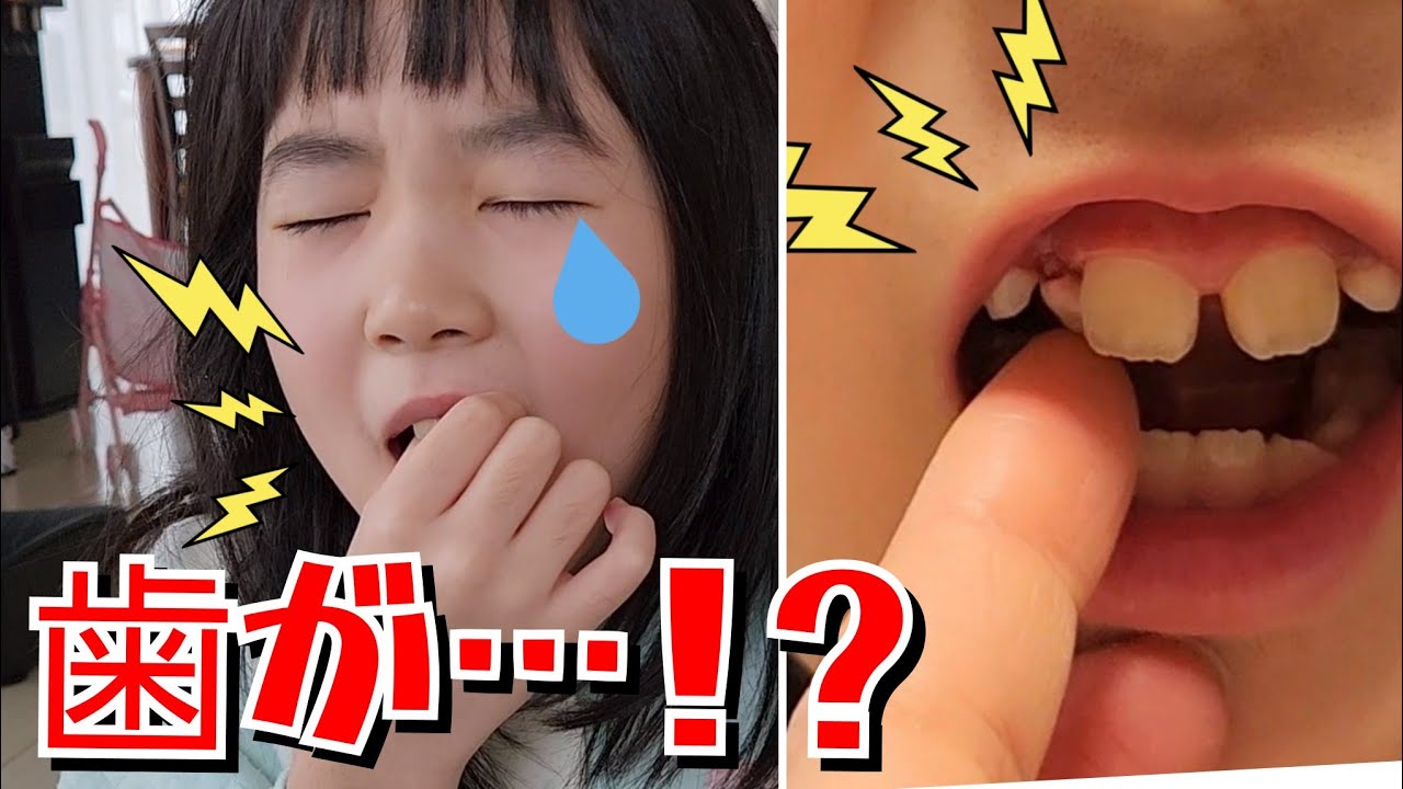 歯が抜けた瞬間！自分で抜いてやる！かほ歯が抜ける成長記録（６才 ７才 ８才）ブログ Vlog kids