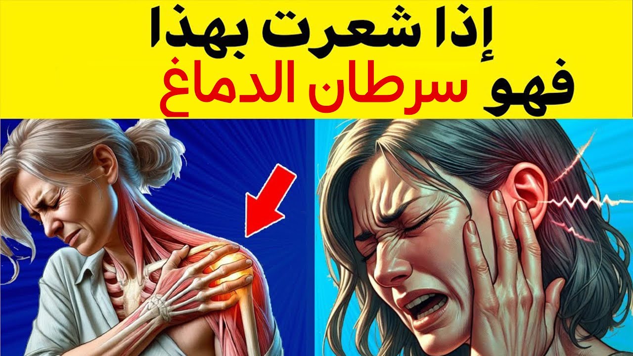 🛑8 علامات مبكرة لسرطان الدماغ  🩺 التي يجب أن تعرفها! 🚨 كن على دراية وقلل المخاطر!