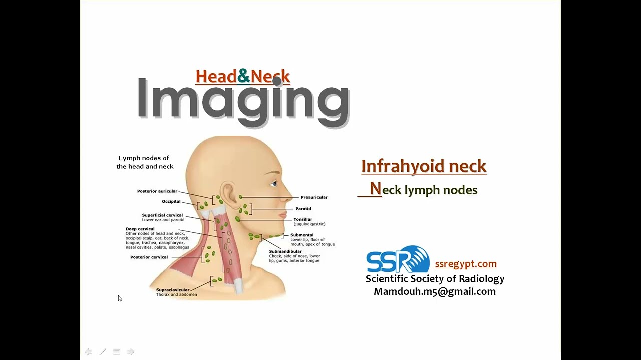 06 Imaging of Cervical lymph nodes  TEC  Prof  Mamdouh Mahfouz