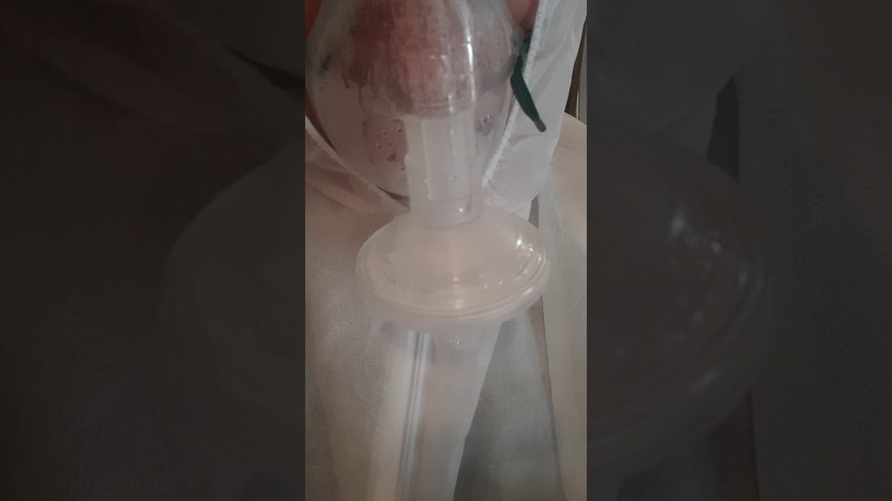 Kondensatas kaukės filtre.