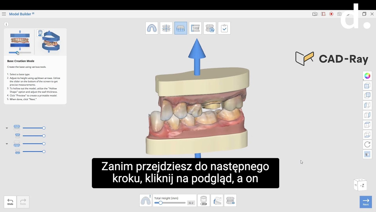 Medit i700 - przygotowanie modelu diagnostycznego PL
