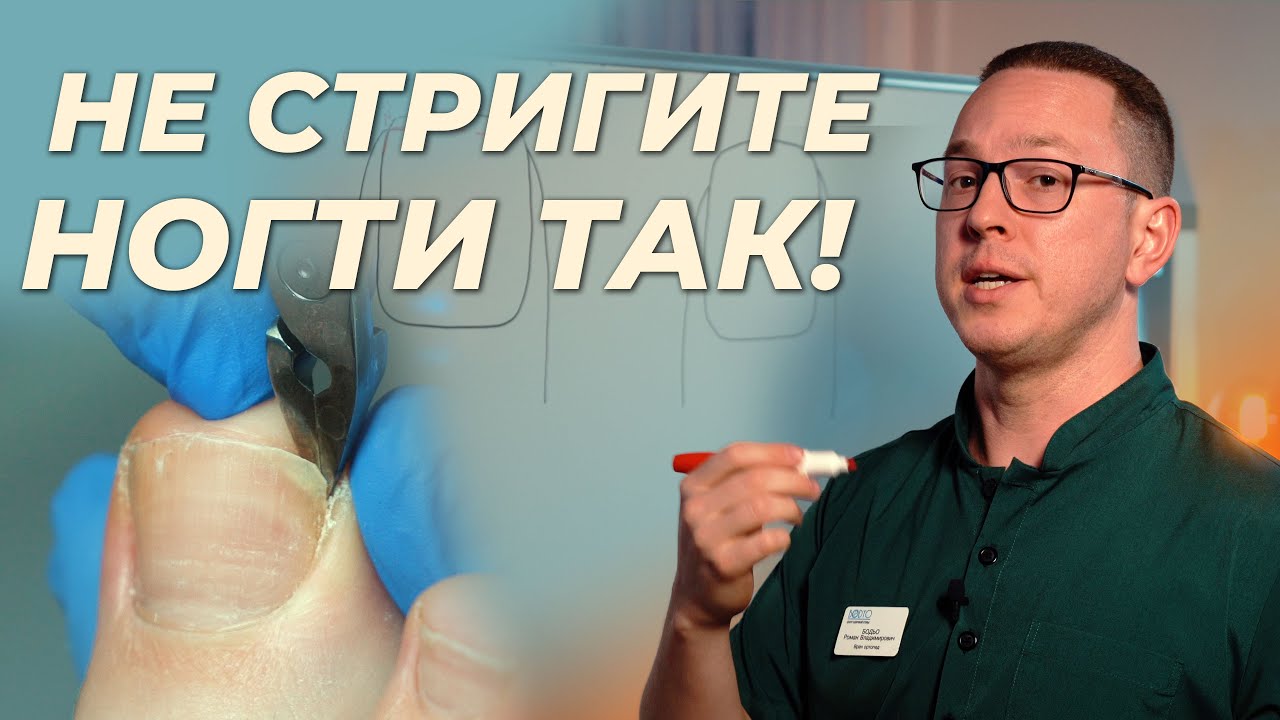 Как подстригать ногти, чтобы не было проблем