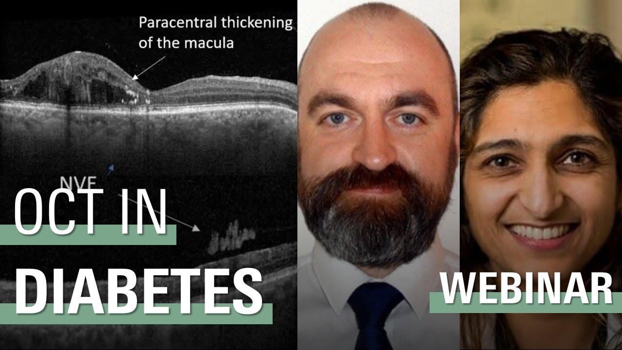OCT Skills for Diabetic Eye Screeners (April 2024)