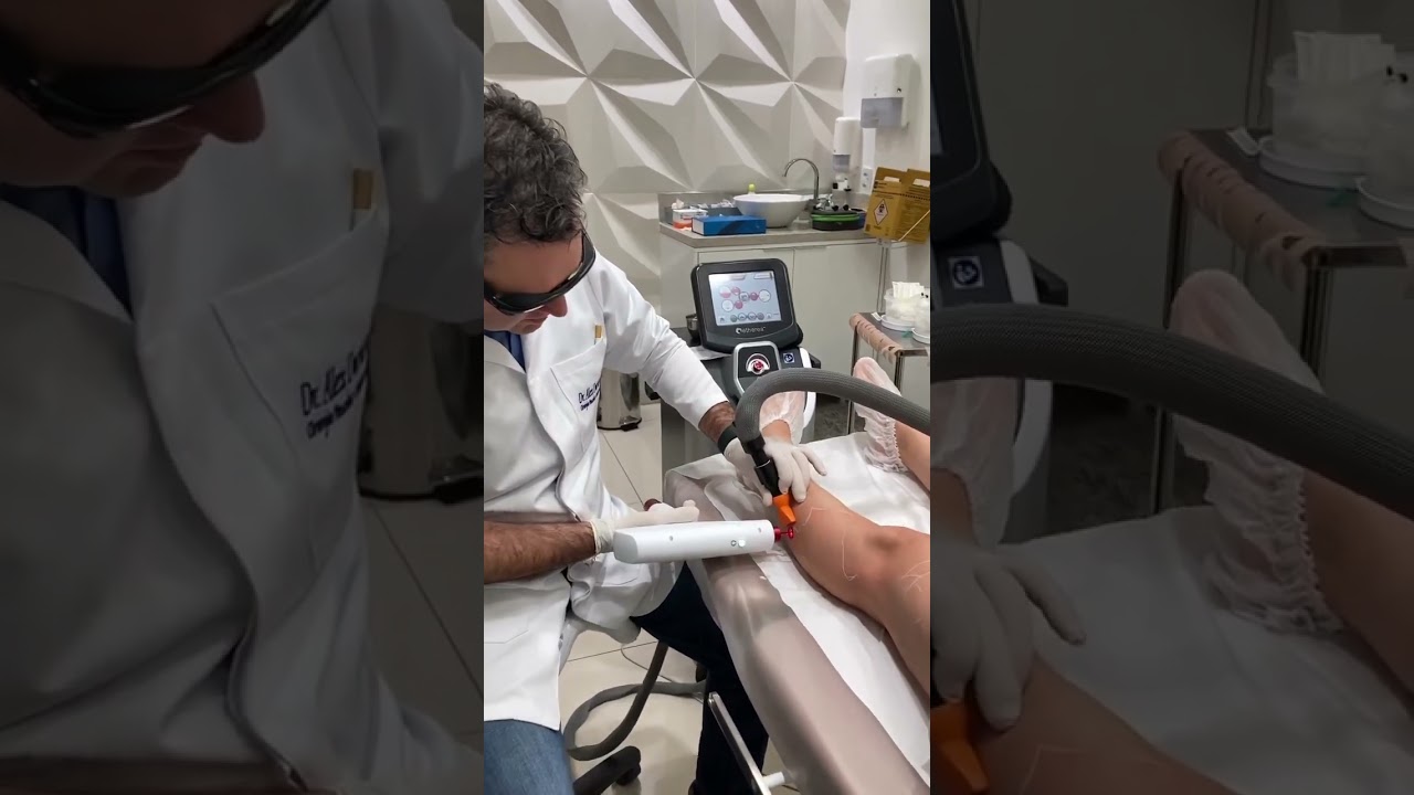Tratamento de microvarizes com laser e escleroterapia.