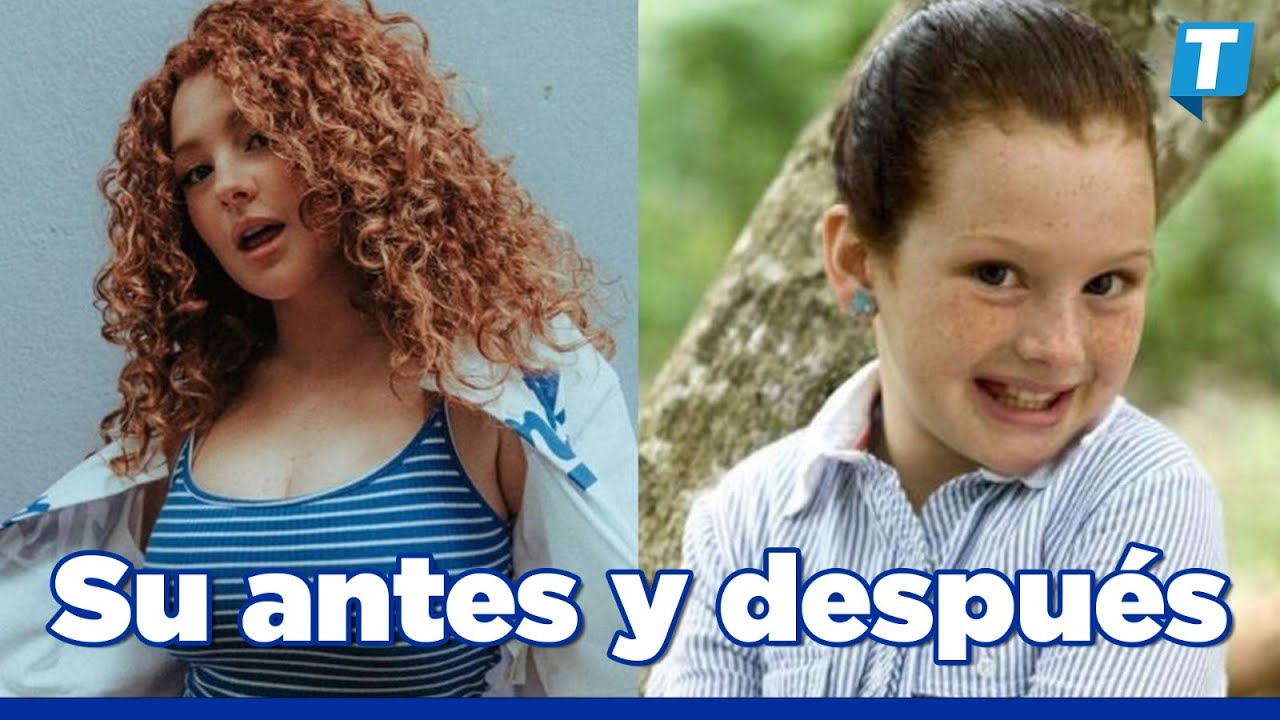 Briggitte Bozzo: Estas son TODAS las CIRUG&Iacute;AS que tiene la famosa 😱