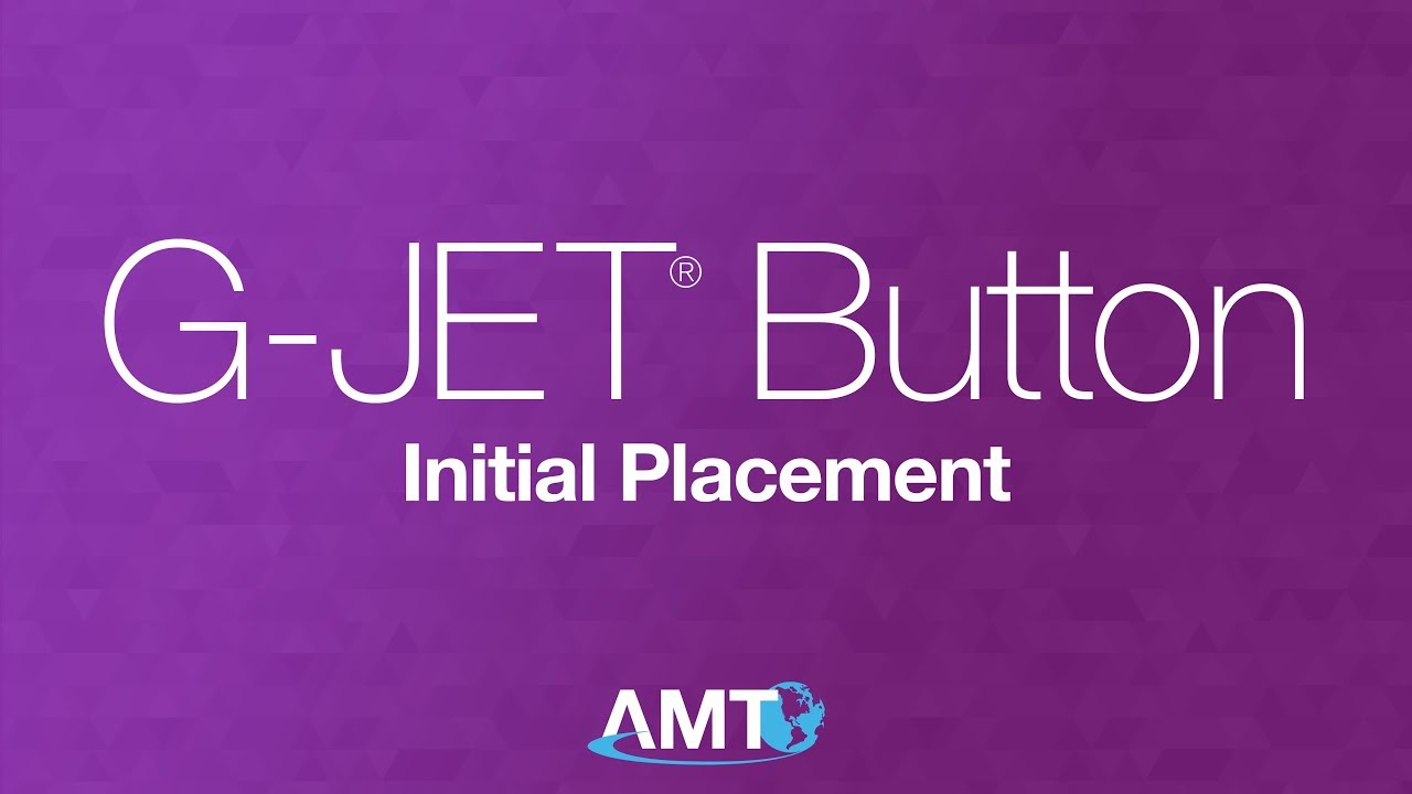 G-JET® Initial Placement