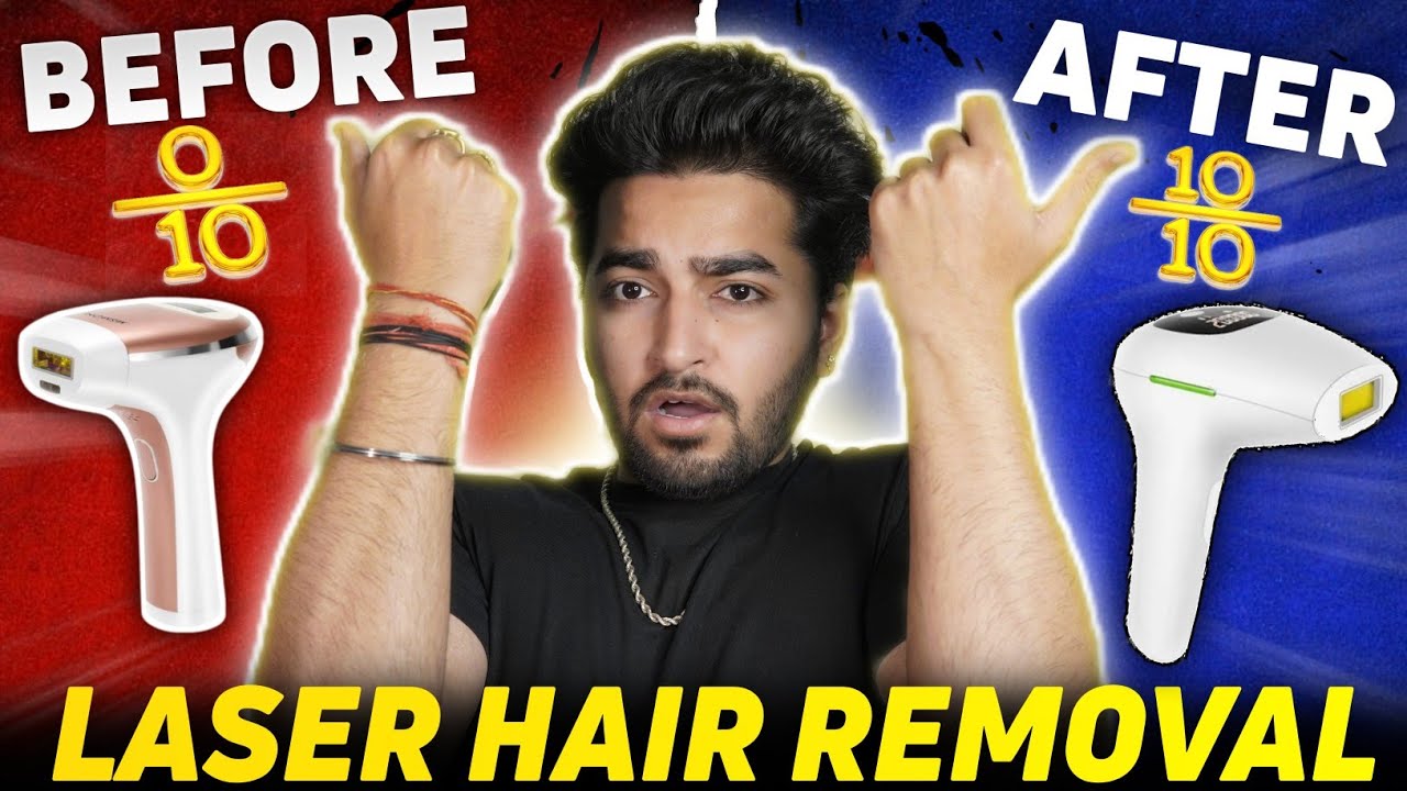 Laser Hair Removal Results After Long Time