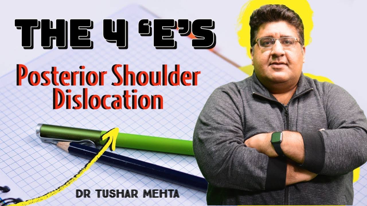 The 4 ‘E’s | Posterior Shoulder Dislocation | @DrTusharMehta #inicet #fmge #neetpg