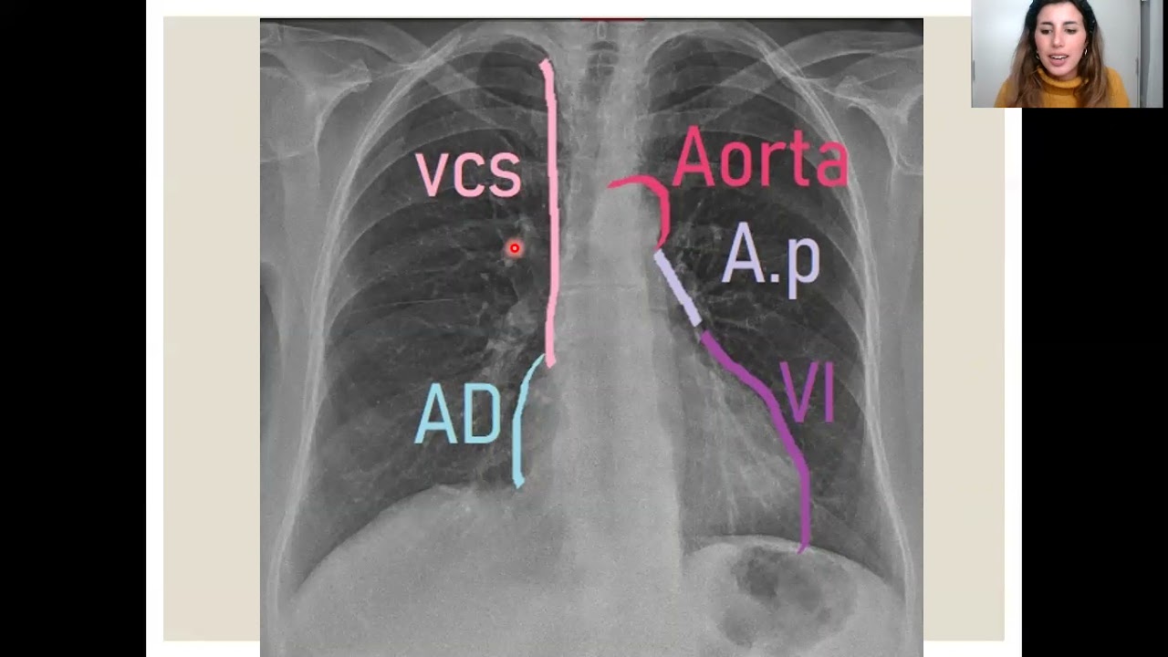 Anatomía por Imágenes - Aparato Cardiovascular
