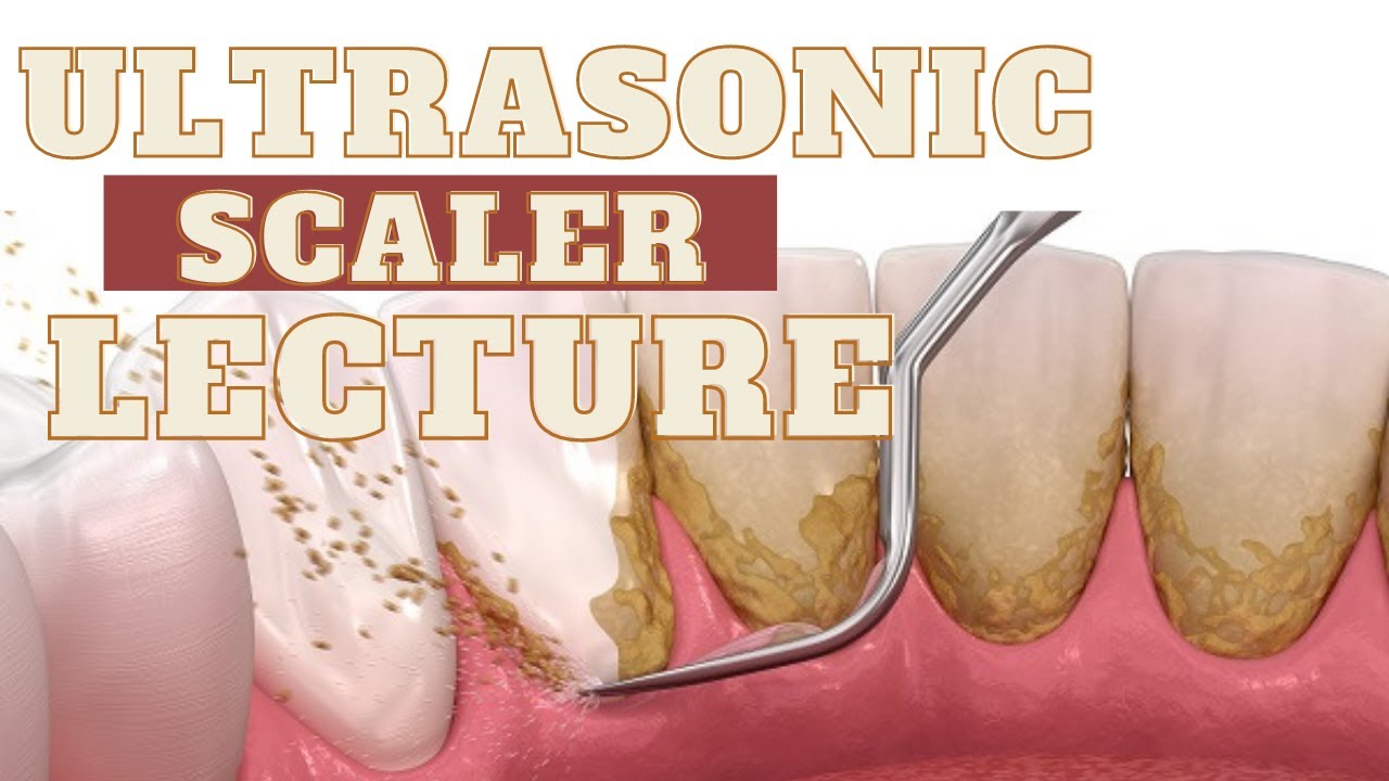 Periodontology Ultrasonic Scalers #periodontology #Ultrasonic #scaler