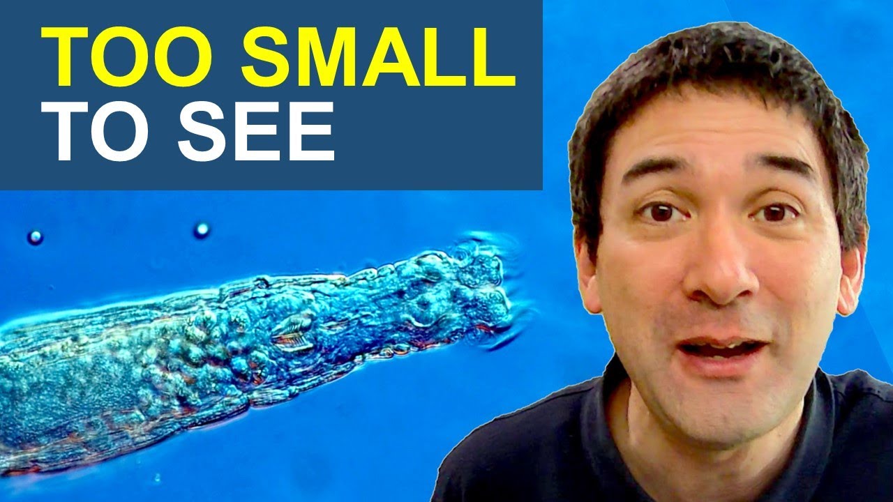 What are the smallest animals? | Rotifers under the microscope