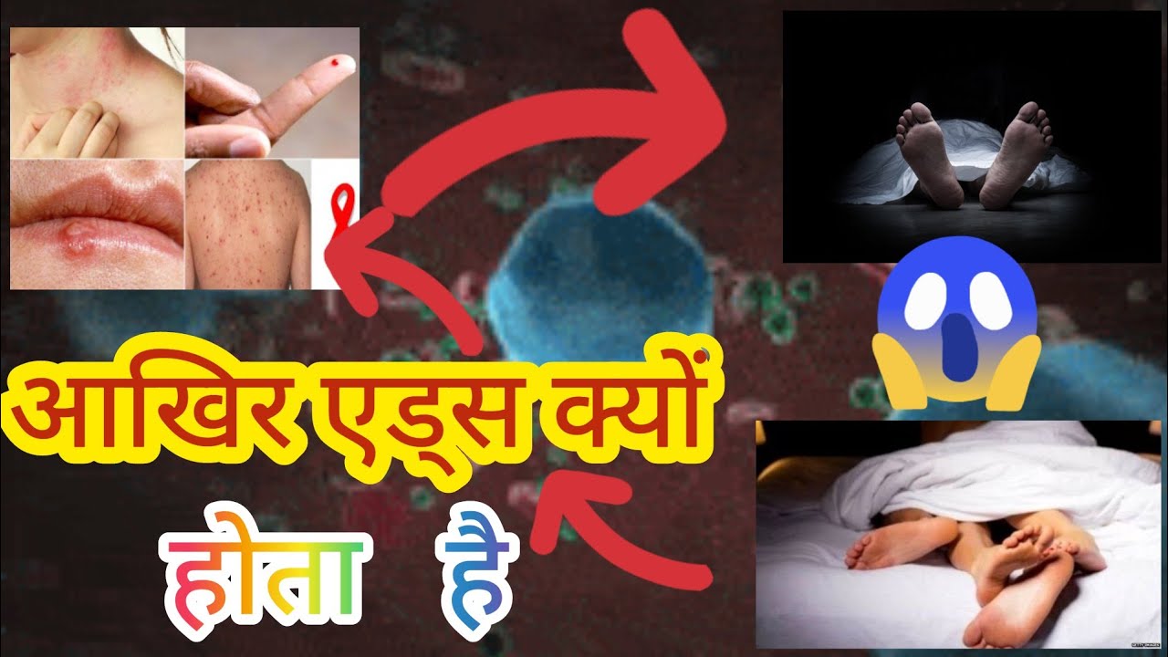 AIDS/HIV/Sexually Transmitted Disease/Retrovirus/Infectious disease