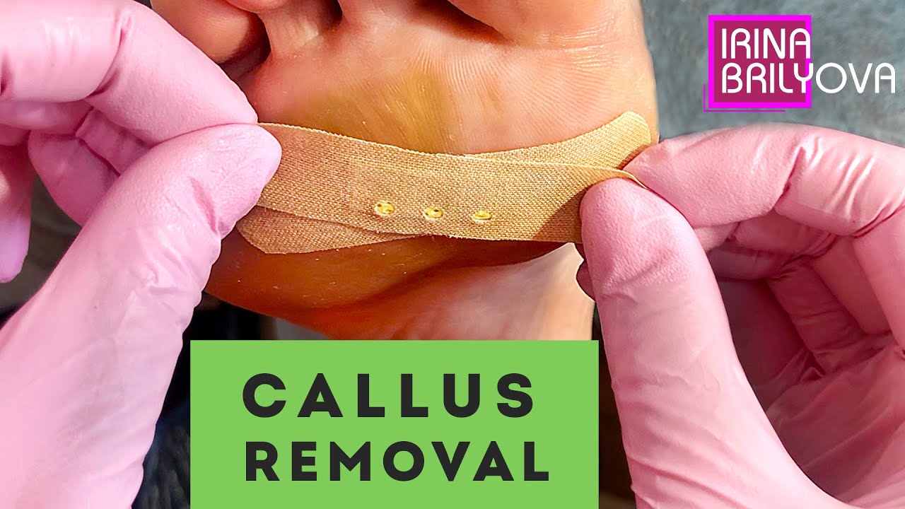 CALLUS removal 🌸 DEEP corn 🌸 Aesthetic PEDICURE 🌸 Irina Brilyova