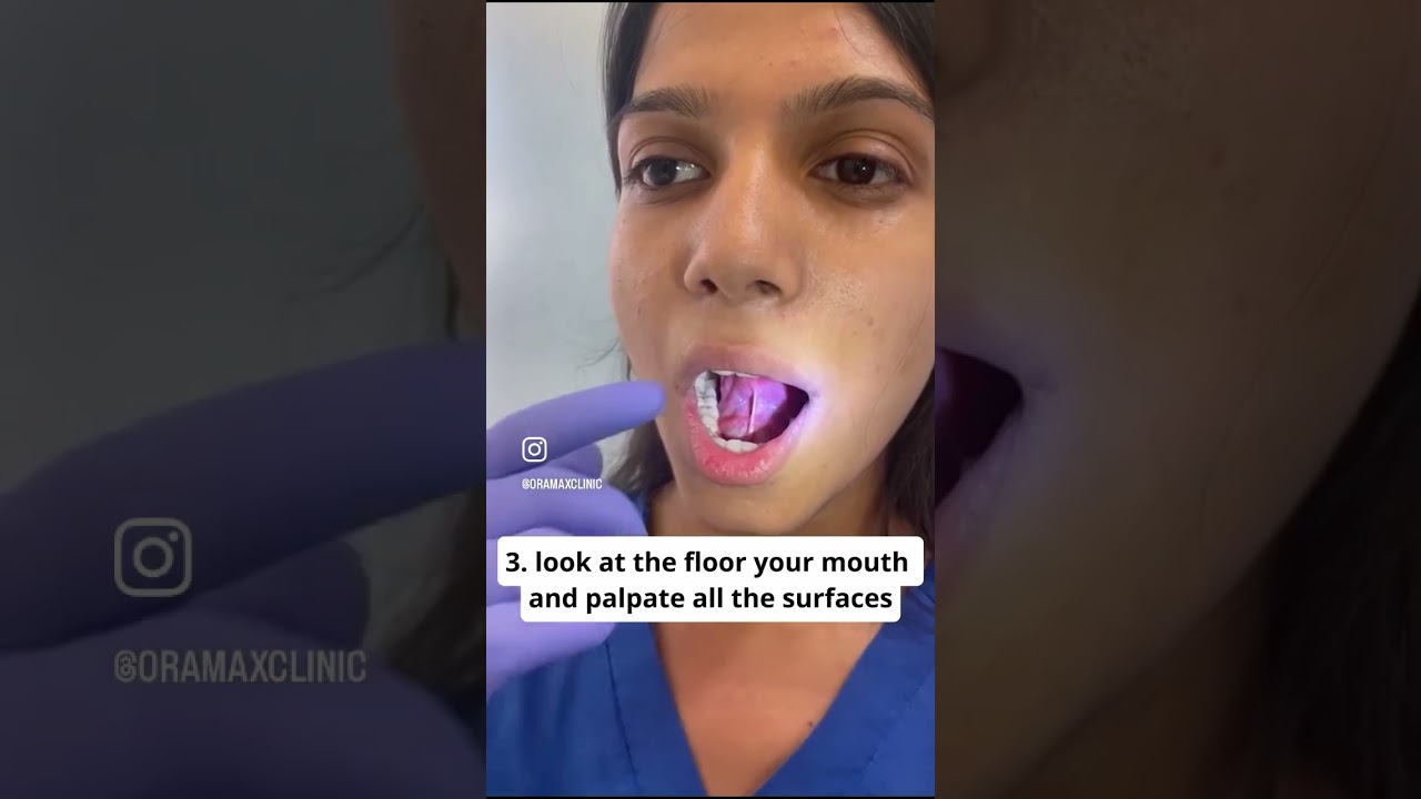 Oral Cancer Self Examination !!                                      #oralcancerexamination