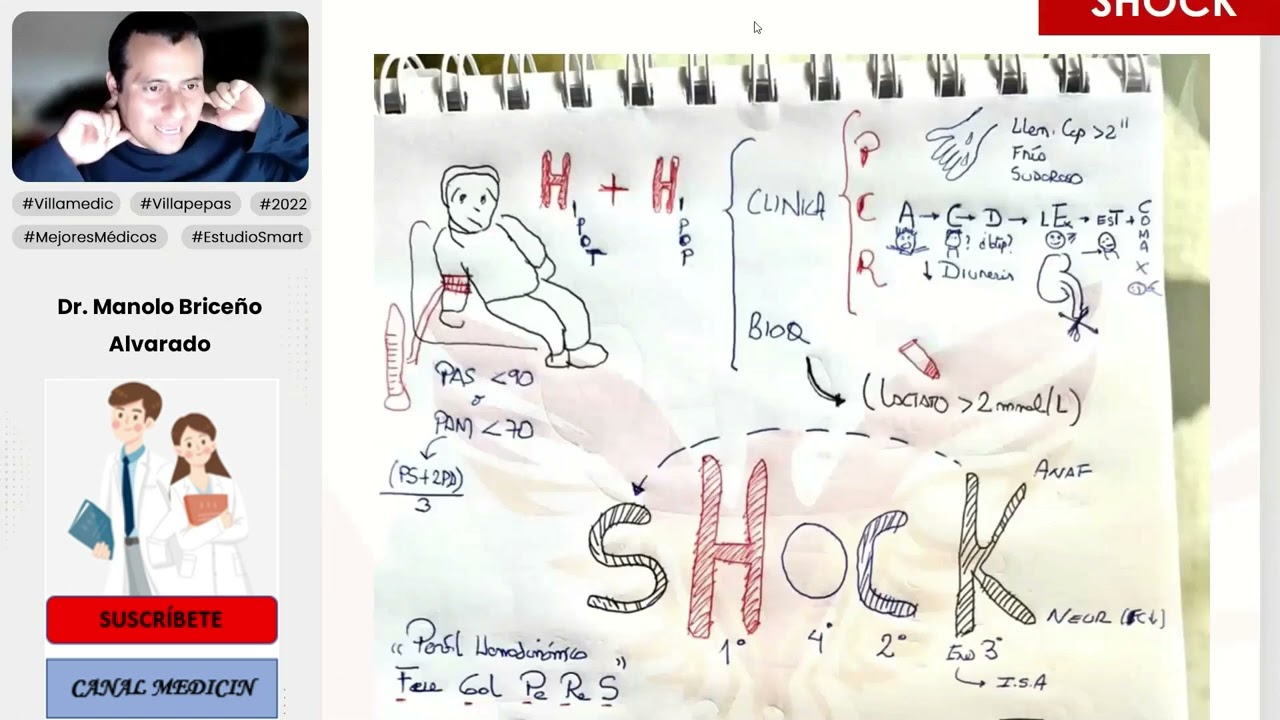 PREGUNTAS ENAM DE SHOCK - CARDIOLOGÍA - VILLAMEDIC